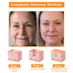 Bee Venom Skin Treatment Cream