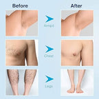 Sydonic Hair removal cream for men & women